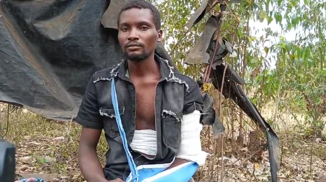 Surviving Police Bullets: Mwea Man’s Plea for Justice Amid Saba Saba Protest Tragedies