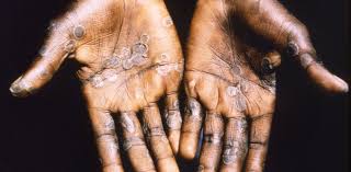 Danger: Six Incurable Diseases You Should Know — Causes and Facts