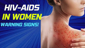 Four Warning Signs of HIV in Women You Should Never Ignore
