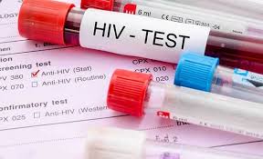 HIV Crisis in Uganda: Hostels and Universities at the Centre of New Infections