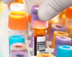 Urine-Based HIV Test Offers Privacy and Hope in Fight Against Stigma